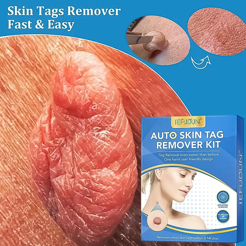 Skin Tag Remover Kit 2 in 1 for Micro to Large